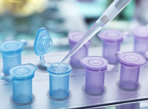 俄羅斯做試管嬰兒到孕晚期如何去判斷胎兒是否缺氧呢